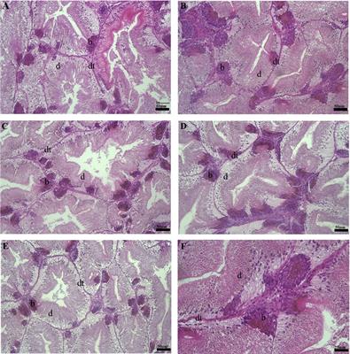 Dietary replacement of Undaria pinnatifida by Sargassum horneri in feed formulation for abalone Haliotis discus hannai: Effect on growth, gut microbiota, and taste sensory profile